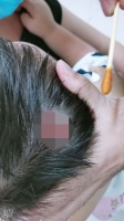 别墅区外墙体脱落 两岁孩童头顶砸出棱形伤口