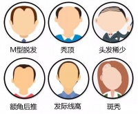 永春优品:打造专业头皮秀发养护品牌