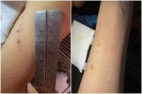 就3·15曝光问题道歉声刚落 万科精装房又现玻璃门炸裂伤人事件