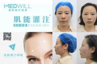 对话|甄蒂:医美行业适合盛产美女的城市